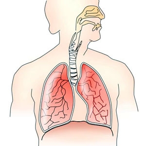 Respiratia dupa leziuni ale maduvei spinarii